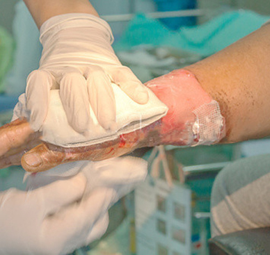 創傷材料 創傷材料