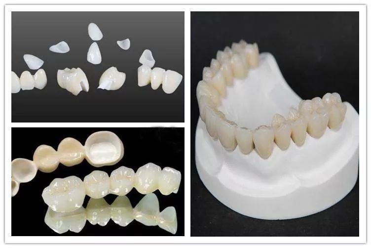Zirconia Crowns