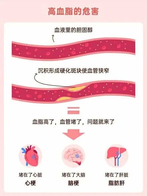 别再误解血脂!《中国血脂管理指南》教你正确设定降脂目标!-广东同江医院